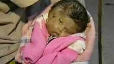 छत्तीसगढ़ में महिला ने तीन आंखों वाले अद्भुत शिशु को जन्म दिया 11 chattisgarh raipur 3 eye child born5 छत्तीसगढ़ में महिला ने तीन आंखों वाले अद्भुत शिशु को जन्म दिया