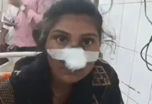 Hardoi UP उप्र के हरदोई में व्यक्ति ने प्रेमी के साथ पकड़ी गई पत्नी की दांत से काटी नाक