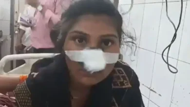 उप्र के हरदोई में व्यक्ति ने प्रेमी के साथ पकड़ी गई पत्नी की दांत से काटी नाक 5 Hardoi UP उप्र के हरदोई में व्यक्ति ने प्रेमी के साथ पकड़ी गई पत्नी की दांत से काटी नाक