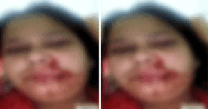 bhopal-In-laws-held-daughter-in-law-hostage-and-beat-her